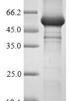 Human Ubiquitin carboxyl-terminal hydrolase 7 (USP7),Partial Recombinant Protein - BioCrest Sci