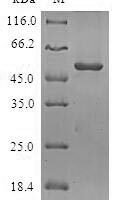 Human Origin recognition complex subunit 6 (ORC6) Recombinant Protein - BioCrest Sci