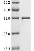 Escherichia coli Aerobic respiration control protein ArcA (arcA) Recombinant Protein - BioCrest Sci