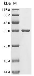 Escherichia coli Aerobic respiration control protein ArcA (arcA) Recombinant Protein, Escherichia coli (strain K12), E.coli, N-terminal 6xHis-tagged, 31.4 kDa, purity >≥ 85% as determined by SDS-PAGE.