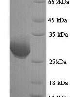 Human Granzyme B (GZMB) Recombinant Protein, N-His, aa 21–247, Yeast - BioCrest Sci