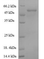 African cassava mosaic virus Replication-associated protein (AC1) Recombinant Protein, N-His-SUMO - BioCrest Sci