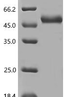 Human Keratin, type I cuticular Ha4 (KRT34) Recombinant Protein, N-10His/C-Myc, aa 1–436, Baculovirus - BioCrest Sci