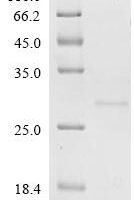 Mycobacterium tuberculosis Co-chaperonin GroES (groES) Recombinant Protein, C-His, aa 1–100, Yeast - BioCrest Sci