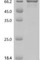 Human Forkhead box protein C1 (FOXC1) Recombinant Protein, C-His - BioCrest Sci