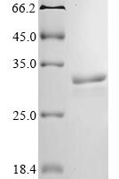 Clostridium acetobutylicum Acetoacetate decarboxylase (adc) Recombinant Protein - BioCrest Sci