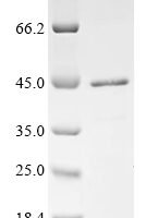 Human Transcription cofactor vestigial-like protein 3 (VGLL3) Recombinant Protein, N-His, aa 1–320, E.coli - BioCrest Sci