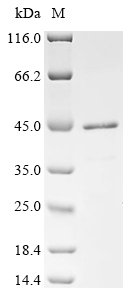 Human Transcription cofactor vestigial-like protein 3 (VGLL3) Recombinant Protein, N-His, aa 1–320, E.coli, Homo sapiens (Human), E.coli, N-terminal 6xHis-tagged, 41.1 kDa, purity >≥ 85% as determined by SDS-PAGE.