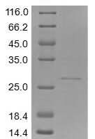 Human Filaggrin (FLG), partial Recombinant Protein, N-His - BioCrest Sci