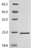 Human Histone H2A.J (H2AJ) Recombinant Protein - BioCrest Sci