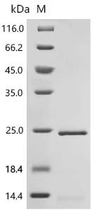Human Histone H2A.J (H2AJ) Recombinant Protein, Homo sapiens (Human), E.coli, C-terminal 6xHis-tagged, 19.9 kDa, purity >≥ 85% as determined by SDS-PAGE.