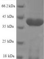 Human NADH dehydrogenase [ubiquinone] iron-sulfur protein 5 (NDUFS5) Recombinant Protein - BioCrest Sci