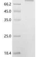 Human Transaldolase (TALDO1) Recombinant Protein, C-hFc1 - BioCrest Sci
