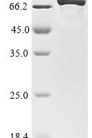 Human Secretogranin-1 (CHGB), partial Recombinant Protein - BioCrest Sci