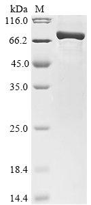 Human Secretogranin-1 (CHGB), partial Recombinant Protein, Homo sapiens (Human), E.coli, N-terminal 6xHis-GST-tagged, 73.5 kDa, purity >≥ 85% as determined by SDS-PAGE.