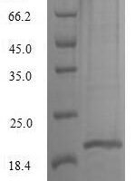 Macaca mulatta Interleukin-10 (IL10) Recombinant Protein, C-10His - BioCrest Sci