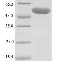 Human Lysyl oxidase homolog 1 (LOXL1) Recombinant Protein, Tag-Free - BioCrest Sci