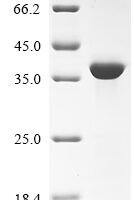 Mouse Napsin-A (Napsa), partial Recombinant Protein - BioCrest Sci