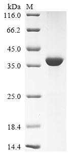 Mouse Napsin-A (Napsa), partial Recombinant Protein, Mus musculus (Mouse), E.coli, N-terminal 6xHis-tagged, 40.5 kDa, purity >≥ 90% as determined by SDS-PAGE.