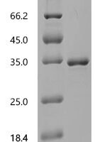 Mouse Dystrophin (Dmd), partial Recombinant Protein, C-His, aa 1–240, E.coli - BioCrest Sci