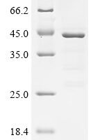 Human C-C motif chemokine 21 (CCL21) Recombinant Protein, N-His-GST - BioCrest Sci