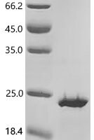 Human T-cell acute lymphocytic leukemia protein 1 (TAL1), partial Recombinant Protein, N-His/C-His - BioCrest Sci