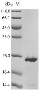 Human T-cell acute lymphocytic leukemia protein 1 (TAL1), partial Recombinant Protein, N-His/C-His, Homo sapiens (Human), E.coli, N-terminal 6xHis-tagged and C-terminal 6xHis-tagged, 18.8 kDa, purity >≥ 90% as determined by SDS-PAGE.