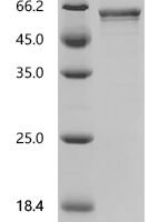 Glycine max 1-aminocyclopropane-1-carboxylate synthase (ACS1) Recombinant Protein - BioCrest Sci
