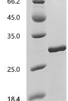 Human Arylsulfatase B (ARSB), partial Recombinant Protein - BioCrest Sci