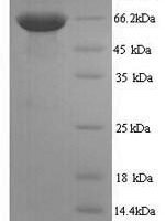 Human Receptor-type tyrosine-protein phosphatase C (PTPRC), partial Recombinant Protein - BioCrest Sci