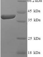 Human Izumo sperm-egg fusion protein 4 (IZUMO4) Recombinant Protein - BioCrest Sci