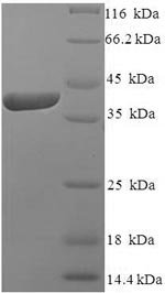 Human Izumo sperm-egg fusion protein 4 (IZUMO4) Recombinant Protein, Homo sapiens (Human), E.coli, N-terminal 6xHis-SUMO-tagged, 39.0 kDa, purity >≥ 90% as determined by SDS-PAGE.