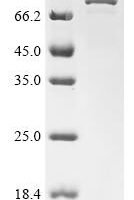 Mouse Putative ATP-dependent RNA helicase Pl10 (D1Pas1) Recombinant Protein - BioCrest Sci