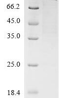 Human Nuclear factor erythroid 2-related factor 2 (NFE2L2) Recombinant Protein - BioCrest Sci