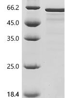 Human TATA-binding protein-associated factor 2N (TAF15), partial Recombinant Protein, N-10His, aa 110–592 - BioCrest Sci