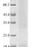 Human E3 ubiquitin-protein ligase TRIP12 (TRIP12), partial Recombinant Protein, N-10His/C-Myc, aa 1881–1992, Baculovirus - BioCrest Sci
