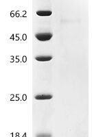 Human Interleukin-13 (IL13) Recombinant Protein, N-His - BioCrest Sci