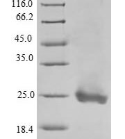 mouse platelet factor 4 (Pf4) Recombinant Protein - BioCrest Sci