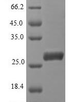Plasmodium falciparum Apical membrane antigen 1 (AMA-1), partial Recombinant Protein - BioCrest Sci