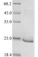 Arabidopsis thaliana E3 SUMO-protein ligase SIZ1 (SIZ1), partial Recombinant Protein - BioCrest Sci