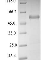 Mouse Aminoacyl tRNA synthase complex-interacting multifunctional protein 1 (Aimp1) Recombinant Protein - BioCrest Sci