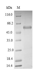 Mouse Aminoacyl tRNA synthase complex-interacting multifunctional protein 1 (Aimp1) Recombinant Protein, Mus musculus (Mouse), E.coli, N-terminal 6xHis-SUMO-tagged, 49.9 kDa, purity >≥ 90% as determined by SDS-PAGE.