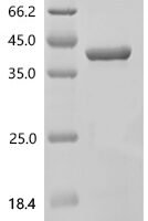 Human Bile salt export pump (ABCB11), partial Recombinant Protein, C-His, aa 1033–1321 - BioCrest Sci