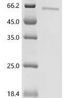 Human Cerebellar degeneration-related protein 2-like (CDR2L) Recombinant Protein, C-His, aa 1–465, Homo sapiens (Human) - BioCrest Sci