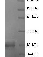 Zaire ebolavirus Envelope glycoprotein (GP), partial Recombinant Protein, N-His - BioCrest Sci