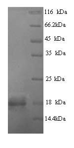 Zaire ebolavirus Envelope glycoprotein (GP), partial Recombinant Protein, N-His, Zaire ebolavirus (strain Eckron-76) (ZEBOV) (Zaire Ebola virus), Yeast, N-terminal 6xHis-tagged, 17.3 kDa, purity >≥ 90% as determined by SDS-PAGE.