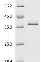 Venezuelan equine encephalitis virus Polyprotein P1234, partial Recombinant Protein, C-His - BioCrest Sci