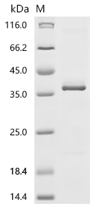 Venezuelan equine encephalitis virus Polyprotein P1234, partial Recombinant Protein, C-His, Venezuelan equine encephalitis virus (strain Trinidad donkey) (VEEV), E.coli, C-terminal 6xHis-tagged, 33.5 kDa, purity >≥ 85% as determined by SDS-PAGE.