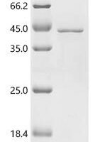 Mouse NADH-cytochrome b5 reductase 3 (Cyb5r3) Recombinant Protein - BioCrest Sci