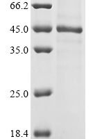 Human Vascular endothelial growth factor C (VEGFC) Recombinant Protein, N-10His - BioCrest Sci